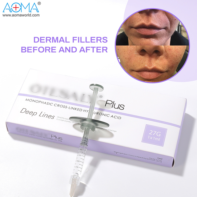 ڪسٽمائيز ٿيل 1ml foosial jwiner jwinline فلر
