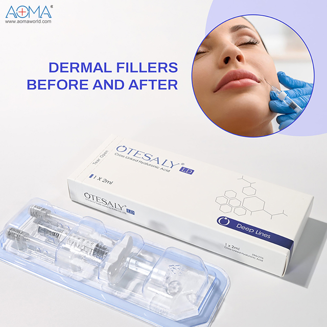 注射式 2ml 利多卡因 利多卡因 鼻樑橋