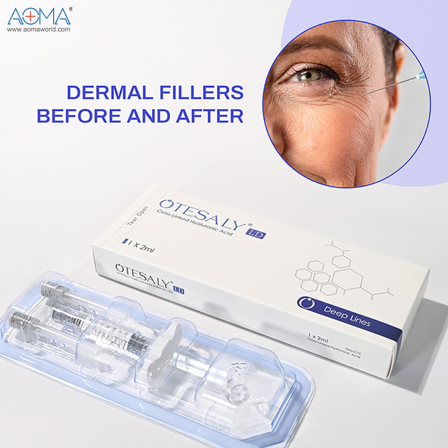 优质 2ml 利多卡因注射填充面部丰盈轮廓