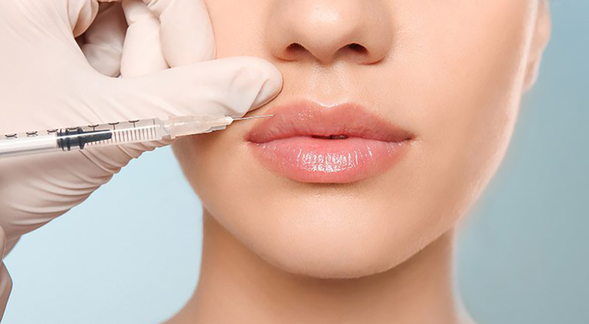 探索用於豐唇的高端透明質酸真皮填充劑
